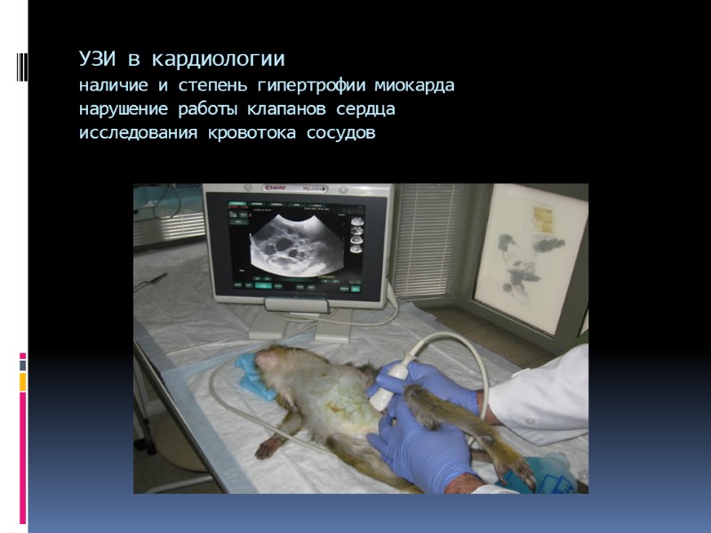 УЗИ в кардиологии наличие и степень гипертрофии миокарда нарушение работы клапанов сердца исследования кровотока